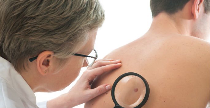 skin-cancer-screenings
