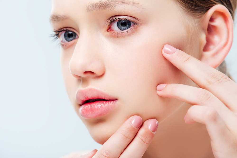 How Long Do Acne Treatments Take? - Premier Dermatology Atlanta